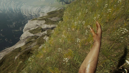 Arm