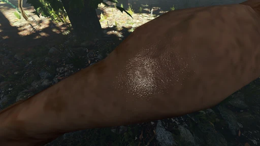 Leg